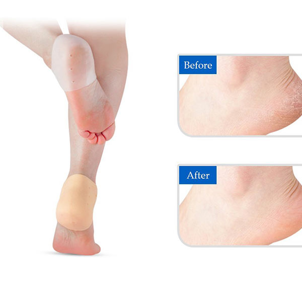 Silicone Heel Protettore del dolore Relief Insole Proteggere il foot Care Gel Heel Cushion ZG -1806