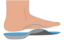 I piedi che indossano insoliti ortopedici è un trattamento